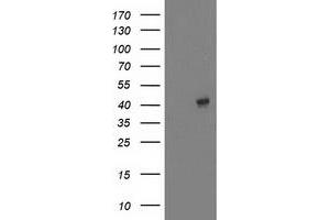Western Blotting (WB) image for anti-Microtubule-Associated Protein, RP/EB Family, Member 2 (MAPRE2) antibody (ABIN1499320) (MAPRE2 antibody)