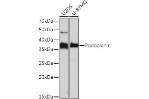Western blot analysis of extracts of various cell lines, using Podoplanin Rabbit mAb (ABIN7269430) at 1:1000 dilution. (Podoplanin antibody)