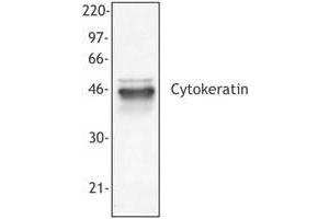 Image no. 1 for anti-pan Keratin (panKRT) antibody (ABIN293953) (pan Keratin antibody)