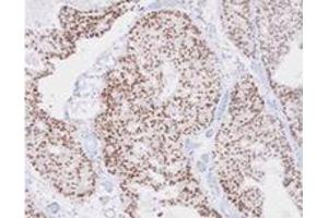 Immunohistochemistry (IHC) image for anti-TAR DNA Binding Protein (TARDBP) (AA 1-260), (N-Term) antibody (ABIN317572) (TARDBP antibody  (N-Term))