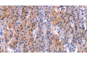 Adrenomedullin 2 antibody