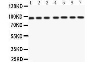 Western Blotting (WB) image for anti-Nibrin (NBN) (AA 714-745), (C-Term) antibody (ABIN3043282) (Nibrin antibody  (C-Term))