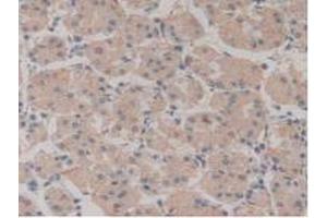 IHC-P analysis of Human Stomach Tissue, with DAB staining. (NUP210 antibody  (AA 1288-1449))