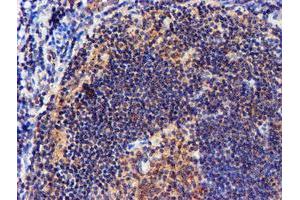 Image no. 5 for anti-NADH Dehydrogenase (Ubiquinone) Complex I, Assembly Factor 7 (NDUFAF7) antibody (ABIN1499667) (NDUFAF7 antibody)