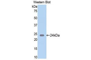 Western Blotting (WB) image for anti-N-Acetylgalactosaminidase, alpha (NAGA) (AA 218-415) antibody (ABIN1859955) (NAGA antibody  (AA 218-415))
