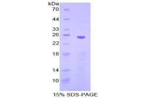 SDS-PAGE (SDS) image for Inhibitor of KB Kinase beta Interacting Protein (IKbIP) (AA 132-314) protein (His tag) (ABIN2125255)