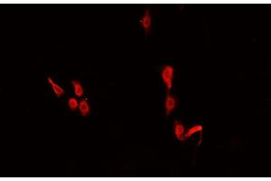 ABIN6266478 staining U-2 OS cells by IF/ICC. (CEBPE antibody  (Internal Region))