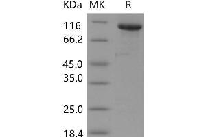 Western Blotting (WB) image for Melanotransferrin (MELTF) protein (Fc Tag) (ABIN7320081) (Melanotransferrin (MELTF) protein (Fc Tag))