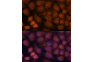Immunofluorescence analysis of HeLa cells using CEP85 antibody (ABIN7266281) at dilution of 1:100. (CEP85 antibody  (AA 130-430))