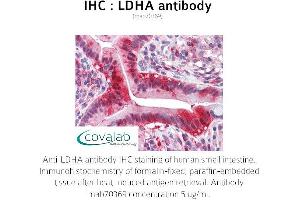 Image no. 2 for anti-Lactate Dehydrogenase A (LDHA) antibody (ABIN1724372) (Lactate Dehydrogenase A antibody)