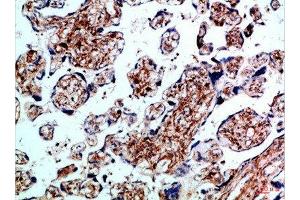 Immunohistochemical analysis of paraffin-embedded Human-placenta, antibody was diluted at 1:100 (BMPR1B antibody  (AA 21-70))
