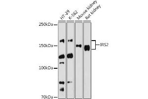 Western blot analysis of extracts of various cell lines, using IRS2 antibody (ABIN6128094, ABIN6142544, ABIN6142545 and ABIN6223949) at 1:500 dilution. (IRS2 antibody  (AA 510-650))