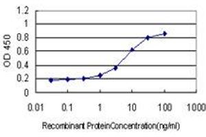 Detection limit for recombinant GST tagged SDSL is approximately 0. (SDSL antibody  (AA 1-329))