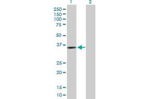 Western Blot analysis of CRELD2 expression in transfected 293T cell line by CRELD2 MaxPab polyclonal antibody. (CRELD2 antibody  (AA 1-321))