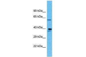 Western Blotting (WB) image for anti-Olfactory Receptor, Family 4, Subfamily K, Member 1 (OR4K1) (C-Term) antibody (ABIN2791739) (OR4K1 antibody  (C-Term))