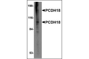 Western blot analysis of PCDH18 in Raji cell lysate with this product at 2 μg/ml.