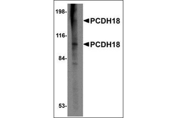 PCDH18 抗体  (N-Term)