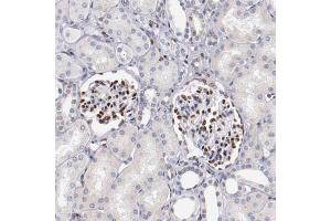 Immunohistochemical staining (Formalin-fixed paraffin-embedded sections) of human kidney shows strong nuclear positivity in cells in glomeruli with SRF polyclonal antibody . (SRF antibody  (AA 339-467))