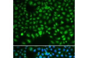 Immunofluorescence analysis of HeLa cells using DLGAP5 Polyclonal Antibody (DLGAP5 antibody)