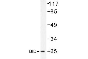 Image no. 1 for anti-BH3 Interacting Domain Death Agonist (BID) antibody (ABIN272120) (BID antibody)