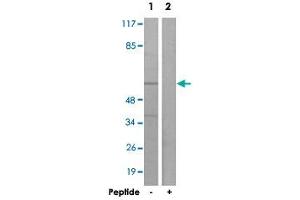 Western blot analysis of extracts from K-562 cells, using ACVRL1 polyclonal antibody .