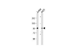All lanes : Anti-NCSTN Antibody (N-Term) at 1:2000 dilution Lane 1: Jurkat whole cell lysates Lane 2: A431 whole cell lysates Lysates/proteins at 20 μg per lane. (Nicastrin antibody  (AA 99-133))