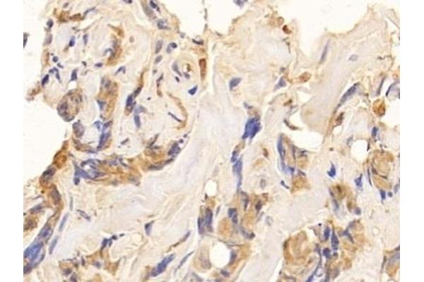 Keratin 10 antibody  (AA 153-456)