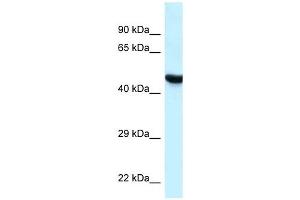 Western Blot showing HYAL3 antibody used at a concentration of 1 ug/ml against MCF7 Cell Lysate (HYAL3 antibody  (C-Term))