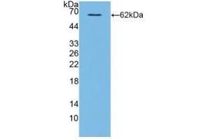 Detection of Recombinant CD40L, Human using Polyclonal Antibody to Cluster Of Differentiation 40 Ligand (CD40L) (CD40 Ligand antibody  (AA 1-261))