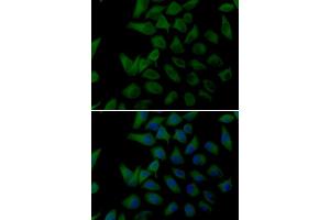 Immunofluorescence analysis of U20S cell using PLOD2 antibody.