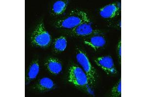 IF analysis of IQGAP1 using anti-IQGAP1 antibody (ABIN6719262). (IQGAP1 antibody)