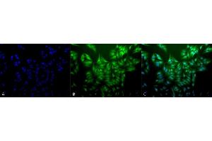 Immunocytochemistry/Immunofluorescence analysis using Mouse Anti-Ubiquitin Monoclonal Antibody, Clone 5B9-B3 (ABIN361810 and ABIN361811). (Ubiquitin antibody)