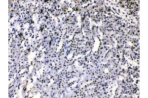 Immunohistochemistry (IHC) image for anti-Heterogeneous Nuclear Ribonucleoprotein A1 (HNRNPA1) (AA 8-42) antibody (ABIN5647145)