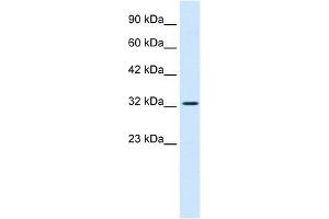 SMARCA2 antibody used at 0. (SMARCA2 antibody  (Middle Region))