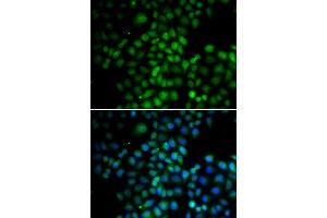 Immunofluorescence analysis of HeLa cells using C11orf30 antibody (ABIN6290348). (EMSY antibody)