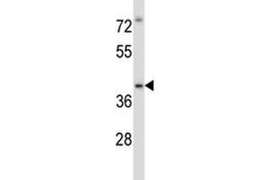 Irak4 antibody western blot analysis in MDA-MB435 lysate. (IRAK4 antibody  (AA 422-449))