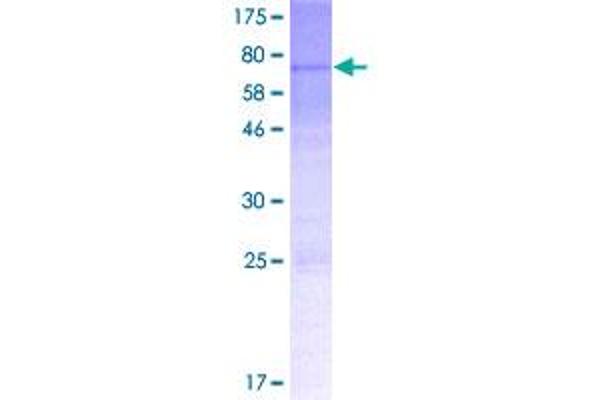 MTERFD1 Protein (AA 1-417) (GST tag)