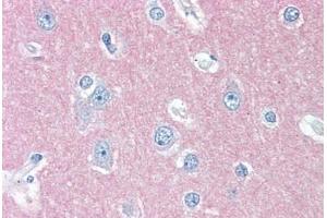 Human Brain, Cortex (formalin-fixed, paraffin-embedded) stained with THY1 antibody ABIN396935 at 10 ug/ml followed by biotinylated anti-mouse IgG secondary antibody ABIN481714, alkaline phosphatase-streptavidin and chromogen. (CD90 antibody)