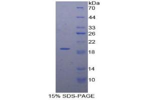 SDS-PAGE analysis of Human DVL1 Protein. (DVL1 Protein)