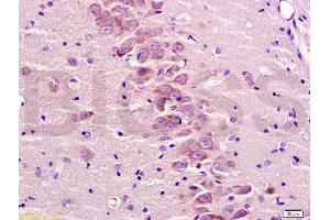 Formalin-fixed and paraffin embedded rat brain tissue labeled with Anti-GRM2/GLUR2 Polyclonal Antibody, Unconjugated (ABIN738561) at 1:300 followed by conjugation to the secondary antibody and DAB staining (GRM2 antibody  (AA 801-872))