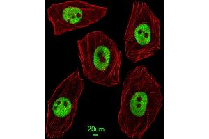 Immunofluorescent analysis of  cells, using UNCX Antibody (C-term) (ABIN655115 and ABIN2844746). (UNCX antibody  (C-Term))