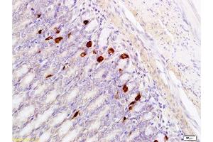 Formalin-fixed and paraffin embedded rat stomach tissue labeled with Anti-GRP Polyclonal Antibody, Unconjugated  at 1:400, followed by conjugation to the secondary antibody and DAB staining (Gastrin-Releasing Peptide antibody  (AA 24-50))