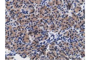 Immunohistochemical staining of paraffin-embedded Human colon tissue using anti-CD80 mouse monoclonal antibody. (CD80 antibody)