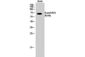 Western Blotting (WB) image for anti-Nuclear Factor (erythroid-Derived 2)-Like 2 (NFE2L2) (acLys599) antibody (ABIN3178881) (NRF2 antibody  (acLys599))