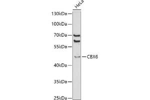 Western blot analysis of extracts of HeLa cells, using CBX6 antibody (ABIN6127558, ABIN6138026, ABIN6138027 and ABIN6221185) at 1:1000 dilution. (CBX6 antibody  (AA 80-180))