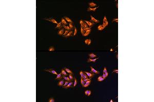 Immunofluorescence analysis of U-2 OS cells using MRPS27 Rabbit pAb  at dilution of 100 (40x lens).
