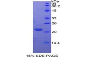 SDS-PAGE analysis of IL17 Protein.