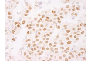 Immunohistochemistry (IHC) image for anti-Antigen Identified By Monoclonal Antibody Ki-67 (MKI67) (AA 1800-1850) antibody (ABIN7448621)