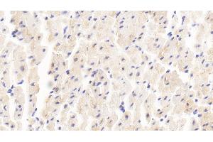 Detection of MYOM2 in Human Cardiac Muscle Tissue using Polyclonal Antibody to Myomesin 2 (MYOM2) (MYOM2 antibody  (AA 1130-1434))