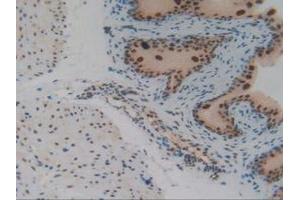 IHC-P analysis of Mouse Vas Deferens Tissue, with DAB staining. (IRF2 antibody  (AA 1-349))